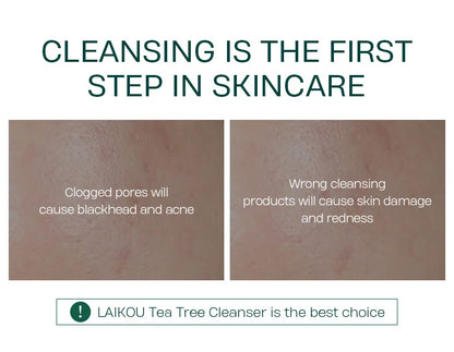 LAlKOU Tea Tree Cleanser Gentle Acne Treatment Blackhead Cleaner Shrink Pore Deep Clean Oil Control Moisturizing Face Skin Care